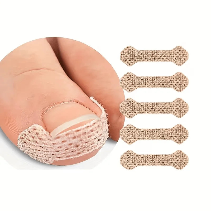 Special tools for ingrown nails, breathable bandages, suitable for foot, hand and nail care.