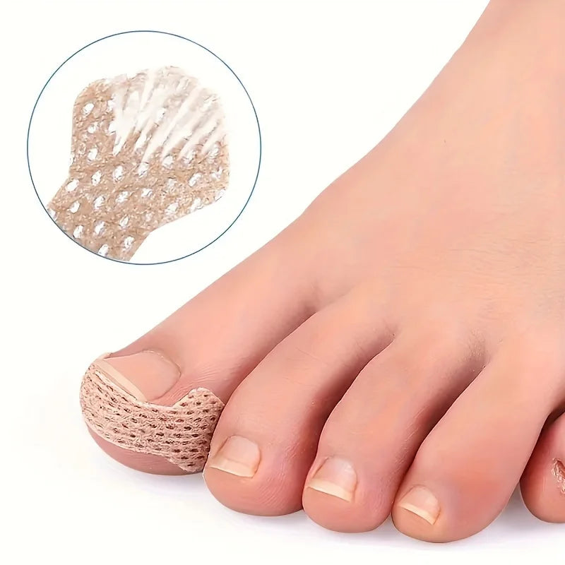 Special tools for ingrown nails, breathable bandages, suitable for foot, hand and nail care.